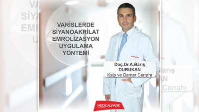 Varislerde Siyonoakrilat Emrolizasyonu